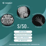 Radiografías