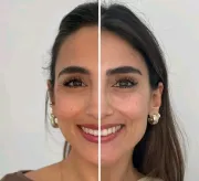Rejuvenece tu rostro. Instagram   imagenclau