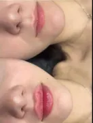 Relleno labial y facial.  iInstagram  IMAGENCLAU